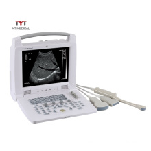 Portable Laptop Veterinary Ultrasound Machine Price